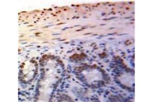 Used in DAB staining on fromalin fixed paraffin-embedded Bowels tissue (PML 抗体  (AA 59-239))