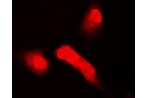 Immunofluorescent analysis of HOS staining in A549 cells. (T-Box 5 抗体)