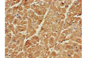 Immunohistochemistry of paraffin-embedded human heart tissue using ABIN7168941 at dilution of 1:100 (SRR 抗体  (AA 1-340))