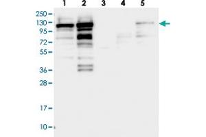Western blot analysis of Lane 1: RT-4, Lane 2: U-251 MG, Lane 3: Human Plasma, Lane 4: Liver, Lane 5: Tonsil with SH3PXD2B polyclonal antibody . (SH3PXD2B 抗体)