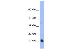 MGC70863 antibody used at 1 ug/ml to detect target protein.