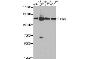 Western blot analysis of extracts of various cell lines, using PHKB antibody. (PHKB 抗体)