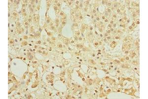 Immunohistochemistry of paraffin-embedded human adrenal gland tissue using ABIN7154963 at dilution of 1:100 (HEMK1 抗体  (AA 1-338))