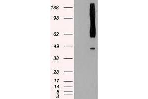 HEK293T cells were transfected with the pCMV6-ENTRY control (Left lane) or pCMV6-ENTRY RAD9A (Right lane) cDNA for 48 hrs and lysed. (RAD9A 抗体)