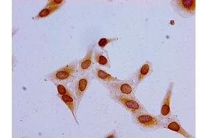 Immunocytochemistry analysis of Hela cells using ABIN7139162 at dilution of 1:100 (HIST1H1C 抗体  (acLys16))