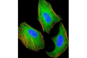 Fluorescent image of Hela cell stained with TSC2 Antibody (ABIN1539797 and ABIN2843773)/SG110509. (Tuberin 抗体)