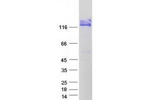 Western Blotting (WB) image for Alanyl (Membrane) Aminopeptidase (ANPEP) protein (Myc-DYKDDDDK Tag) (ABIN2713404)