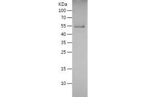Western Blotting (WB) image for Protein tyrosine Phosphatase, Receptor Type, C (PTPRC) (AA 915-1306) protein (His tag) (ABIN7124683) (CD45 Protein (AA 915-1306) (His tag))
