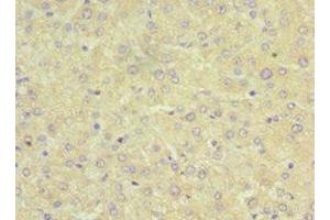Immunohistochemistry of paraffin-embedded human liver tissue using ABIN7170334 at dilution of 1:100 (SRI 抗体  (AA 1-198))