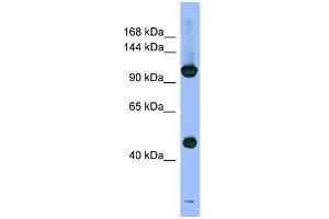WB Suggested Anti-PSMD1 Antibody Titration: 0.