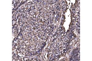 IHC analysis of EXOSC3 using anti-EXOSC3 antibody (ABIN7602216). (EXOSC3 抗体  (AA 64-275))