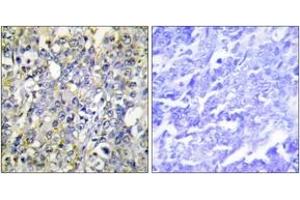 Immunohistochemistry (IHC) image for anti-Insulin-Like Growth Factor Binding Protein 3 (IGFBP3) (AA 151-200) antibody (ABIN1532685)