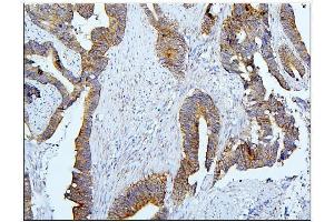 IHC analysis of BubR1/BUB1B using anti-BubR1/BUB1B antibody (ABIN7600962). (BUB1B 抗体  (AA 26-448))