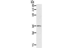 Western Blotting (WB) image for anti-Ring Finger Protein 144B (RNF144B) antibody (ABIN2430277) (RNF144B 抗体)
