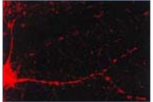 Immunofluorescence (IF) image for anti-Calcium/calmodulin-Dependent Protein Kinase II alpha (CAMK2A) antibody (ABIN492419) (CAMK2A 抗体)