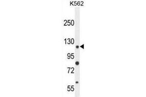 ANR52 Antibody (N-term) western blot analysis in K562 cell line lysates (35µg/lane). (ANKRD52 抗体  (N-Term))