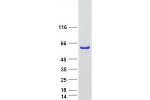 Validation with Western Blot