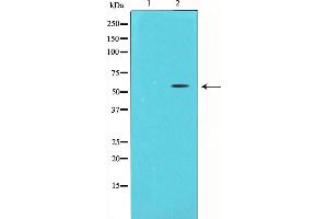 Western blot analysis of Chk1 expression in HeLa whole cell lysates,The lane on the left is treated with the antigen-specific peptide. (CHEK1 抗体  (Internal Region))