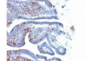 Immunohistochemistry (IHC) image for anti-SRY (Sex Determining Region Y)-Box 2 (SOX2) (AA 176-305) antibody (ABIN6940611)