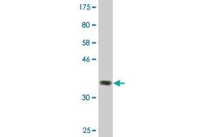 Western Blot detection against Immunogen (36. (ZFYVE16 抗体  (AA 1-100))