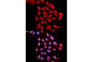 Immunofluorescence analysis of U2OS cells using PSMA6 antibody. (PSMA6 抗体  (AA 1-246))
