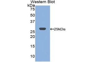 Detection of Recombinant CRP,Cavia using Polyclonal Antibody to C Reactive Protein (CRP) (CRP 抗体  (AA 20-225))