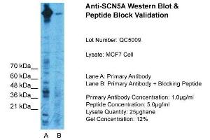 Host:  Rabbit  Target Name:  SCN5A  Sample Type:  MCF7 Whole Cell  Lane A:  Primary Antibody  Lane B:  Primary Antibody + Blocking Peptide  Primary Antibody Concentration:  1ug/ml  Peptide Concentration:  5ug/ml  Lysate Quantity:  25ug/lane/Lane  Gel Concentration:  0. (SCN5A 抗体  (C-Term))