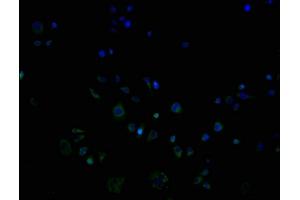 ImmunofluorescencestainingofPC3cellswithABIN7162195at1:100,counter-stainedwithDAPI. (OR9G1 抗体  (AA 290-304))