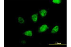 Immunofluorescence of purified MaxPab antibody to MLF2 on HeLa cell. (MLF2 抗体  (AA 1-248))