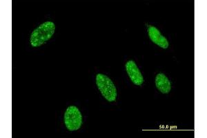 Immunofluorescence of monoclonal antibody to NEUROG3 on HeLa cell. (Neurogenin 3 抗体  (AA 1-101))