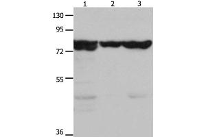 Western Blot analysis of Mouse kidney tissue, 293T and hela cell using HSP75 Polyclonal Antibody at dilution of 1:1500 (TRAP1 抗体)
