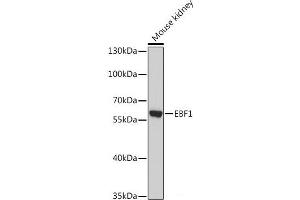 Western blot analysis of extracts of Mouse kidney using EBF1 Polyclonal Antibody at dilution of 1:1000. (EBF1 抗体)