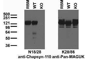 anti-Discs, Large Homolog 2 (DLG2) (AA 1-852) antibody