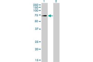 Western Blot analysis of TRIM32 expression in transfected 293T cell line by TRIM32 monoclonal antibody (M09), clone 2E5. (TRIM32 抗体  (AA 105-204))