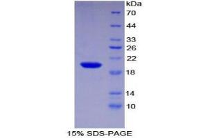 SDS-PAGE (SDS) image for Centromere Protein E, 312kDa (CENPE) (AA 2450-2590) protein (His tag) (ABIN1877281) (CENPE Protein (AA 2450-2590) (His tag))