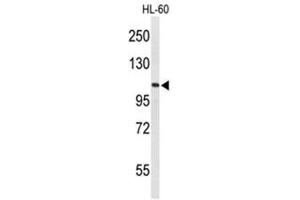 Western blot analysis of AF5q31 Antibody (N-term) in HL-60 cell line lysates (35µg/lane). (AFF4 抗体  (N-Term))