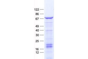 Validation with Western Blot