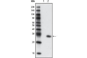 Western blot analysis using GFP mouse mAb against extracts from HCC827 cells, untransfected (1) and transfected with GFP(2). (GFP 抗体)