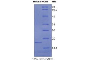 SDS-PAGE analysis of Mouse NOS3 Protein. (ENOS 蛋白)