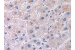 Detection of OTUB1 in Human Liver Tissue using Polyclonal Antibody to Otubain 1 (OTUB1) (OTUB1 抗体  (AA 1-271))
