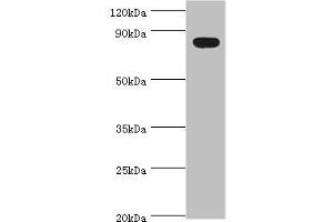 Western Blotting (WB) image for anti-BTB and CNC Homology 1, Basic Leucine Zipper Transcription Factor 1 (BACH1) (AA 1-320) antibody (ABIN7172717)