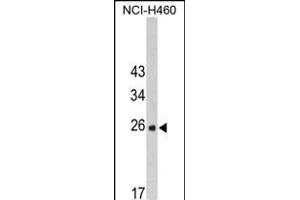 Western blot analysis of FKBP14 Antibody (N-term) (ABIN390491 and ABIN2840850) in NCI- cell line lysates (35 μg/lane). (FKBP14 抗体  (N-Term))