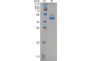 SDS-PAGE (SDS) image for Neurofilament, Light Polypeptide (NEFL) (AA 2-543) protein (Fc Tag) (ABIN7092812)