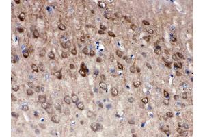 Anti- PGP9. (UCHL1 抗体  (C-Term))