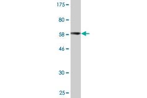 Western Blot detection against Immunogen (62. (PARVG 抗体  (AA 1-331))