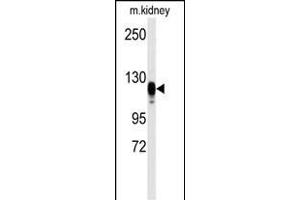 Western blot analysis of anti-EGFR Antibody  s in kidney heart tissue lysates (35 μg/lane). (EGFR 抗体  (AA 1048-1077))