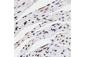 Immunohistochemistry (IHC) image for anti-High Mobility Group Box 1 (HMGB1) (AA 100-200) antibody (ABIN3023358)