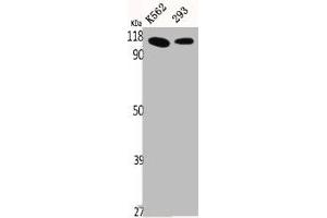 Western Blot analysis of K562 293 cells using p115 Polyclonal Antibody (USO1 抗体  (C-Term))