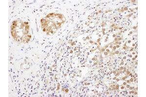 Immunohistochemistry (IHC) image for anti-Translin-Associated Factor X (TSNAX) (AA 240-290) antibody (ABIN7453532) (TSNAX 抗体  (AA 240-290))