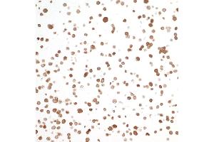 Immunocytochemistry (ICC) image for anti-Nicotinamide phosphoribosyltransferase (NAMPT) (AA 400-450) antibody (ABIN7454014) (Recombinant NAMPT 抗体  (AA 400-450))